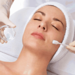 chemicalpeel